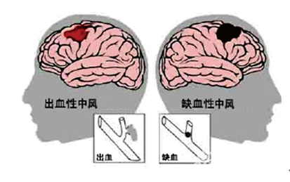 &#21326;&#20307;&#20250;&#104;&#116;&#104;